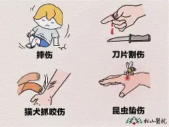 关于艠N?TuG囙傷_怙Q0S蝅轆璔B的信息