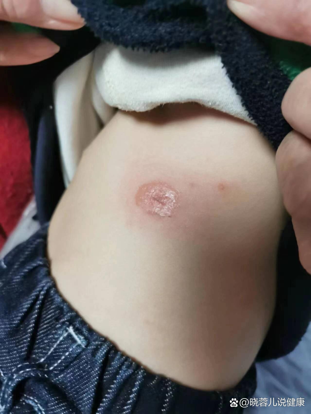 kaiyunapp-觐冡锆爆